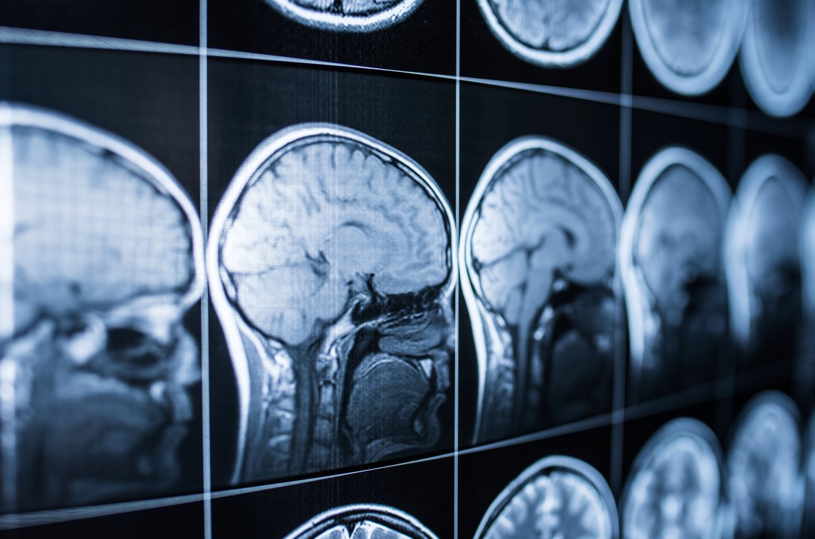 Brain donation has helped researchers and doctors to better understand diseases such as #Schizophrenia, #Alzheimers and #Parkinsons 🧠 See our list of human tissue banks which accept brain and spinal tissue for research... 📃 hta.gov.uk/guidance-publi…