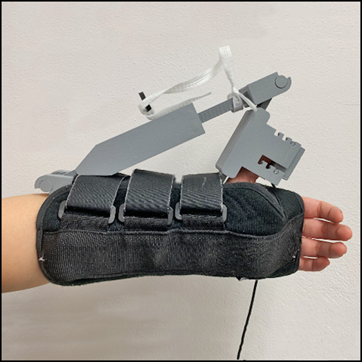 _Anesthesiology's tweet photo. A new laboratory-built #mechanomyograph and an archival mechanomyograph obtained similar train-of-four ratio measurements, reassuring comparability of past and future studies performed with modern mechanomyography systems. Read more: https://t.co/OGMUPjYhD3 https://t.co/GktNGwADsq