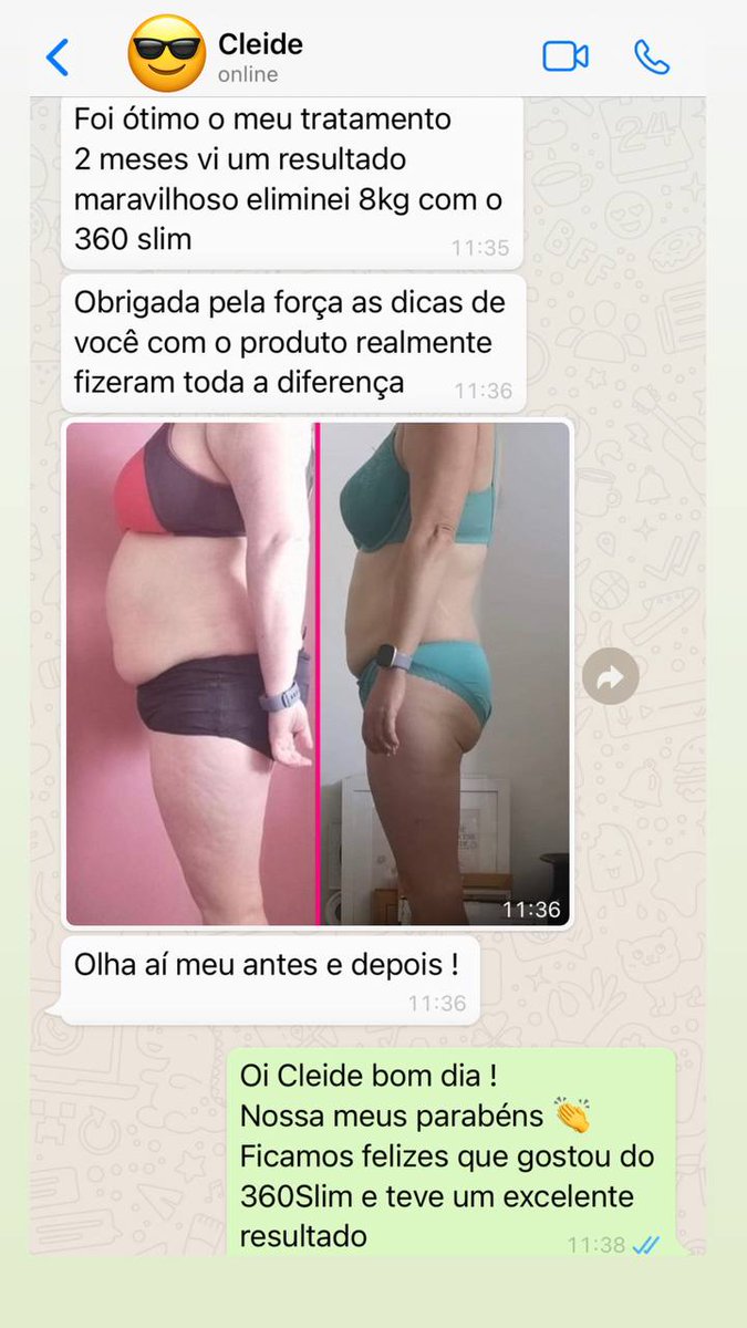 SaudavelMelhor's tweet photo. ✅️ Descubra como o 360Slim Power pode transformar sua vida. Com ingredientes 100% naturais, esse poderoso suplemento é projetado para proporcionar resultados gratificantes no seu processo de emagrecimento.

Saiba mais 👇 https://t.co/0dkdNsx44u

#emagrecer #percapeso #emagreca https://t.co/SV4wsEqnql
