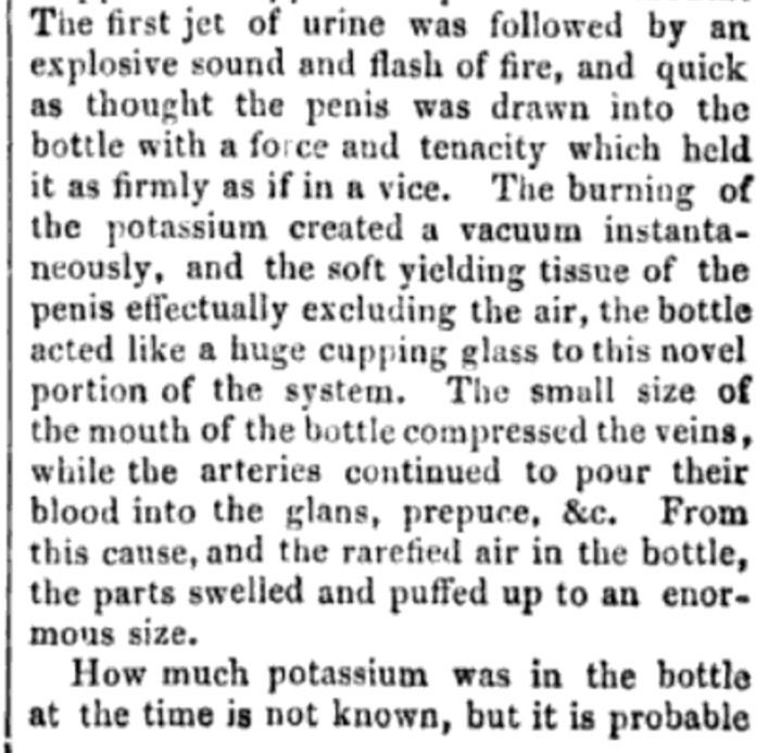 In 1848, an anonymous young man woke in the night to pee. He didn’t want to leave the room, so found a bottle. He didn’t realise it contained potassium, which burns on contact with water. His penis was instantly sucked into the bottle &amp; couldn’t be removed. Read the case here
👇🏼
