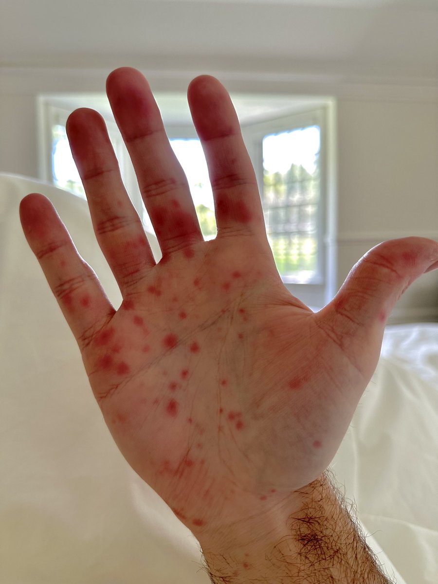 Can I interest you in some Coxsackie virus? Seems like a very special strain, something exotic. ✋