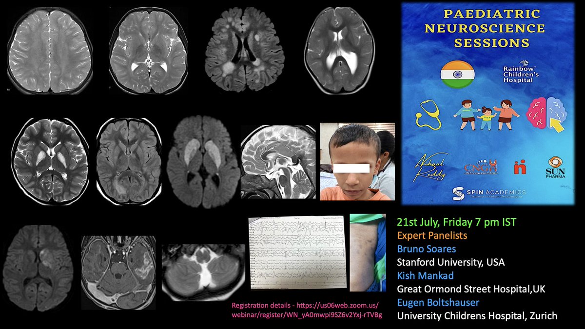 📣 Join us tom evening for  🇮🇳 Paediatric Neuroscience MDT in collaboration with <a href="/spinacademics/">SPIN | Society of Pediatric Neuroimaging</a>! 🧠🌟,
experts and gurus  <a href="/drmankad/">Dr Kish Mankad</a> <a href="/BPSoaresMD/">Bruno P. Soares</a> &amp; Prof Eugen Boltshauser.
One time registration-us06web.zoom.us/webinar/regist…
#pedineurorad #pedsneuro 
#neurorad #radres