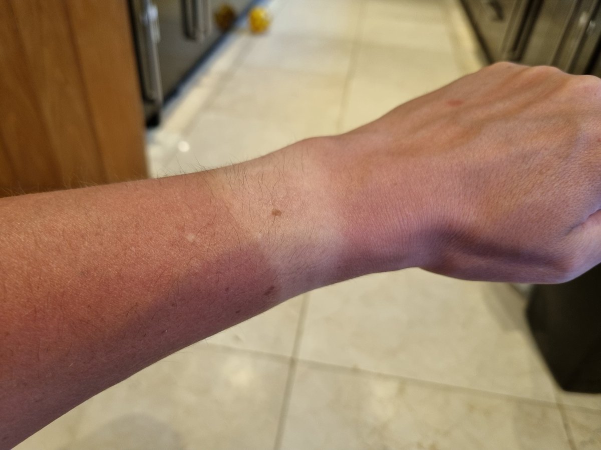 An occupational hazard I won't have to endure next year.

One day to go.