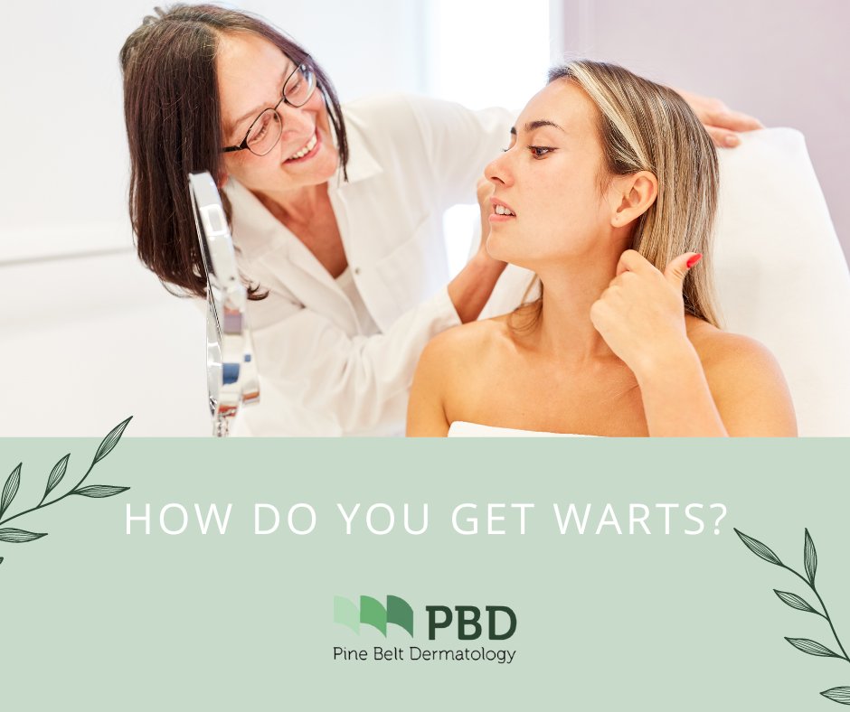 How do you get Warts? Warts are caused by direct skin-to-skin contact with the human papillomavirus (HPV). Avoid sharing personal items, and maintain good hygiene. Stay vigilant, but don't worry—knowledge and prevention are your best allies!

Read more: bit.ly/3XImAj1