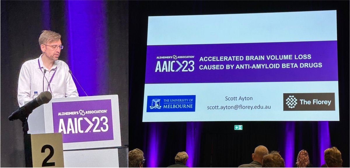 AAIC23- what a conference! I was grateful to share our work on brain volume loss caused by anti amyloid drugs.