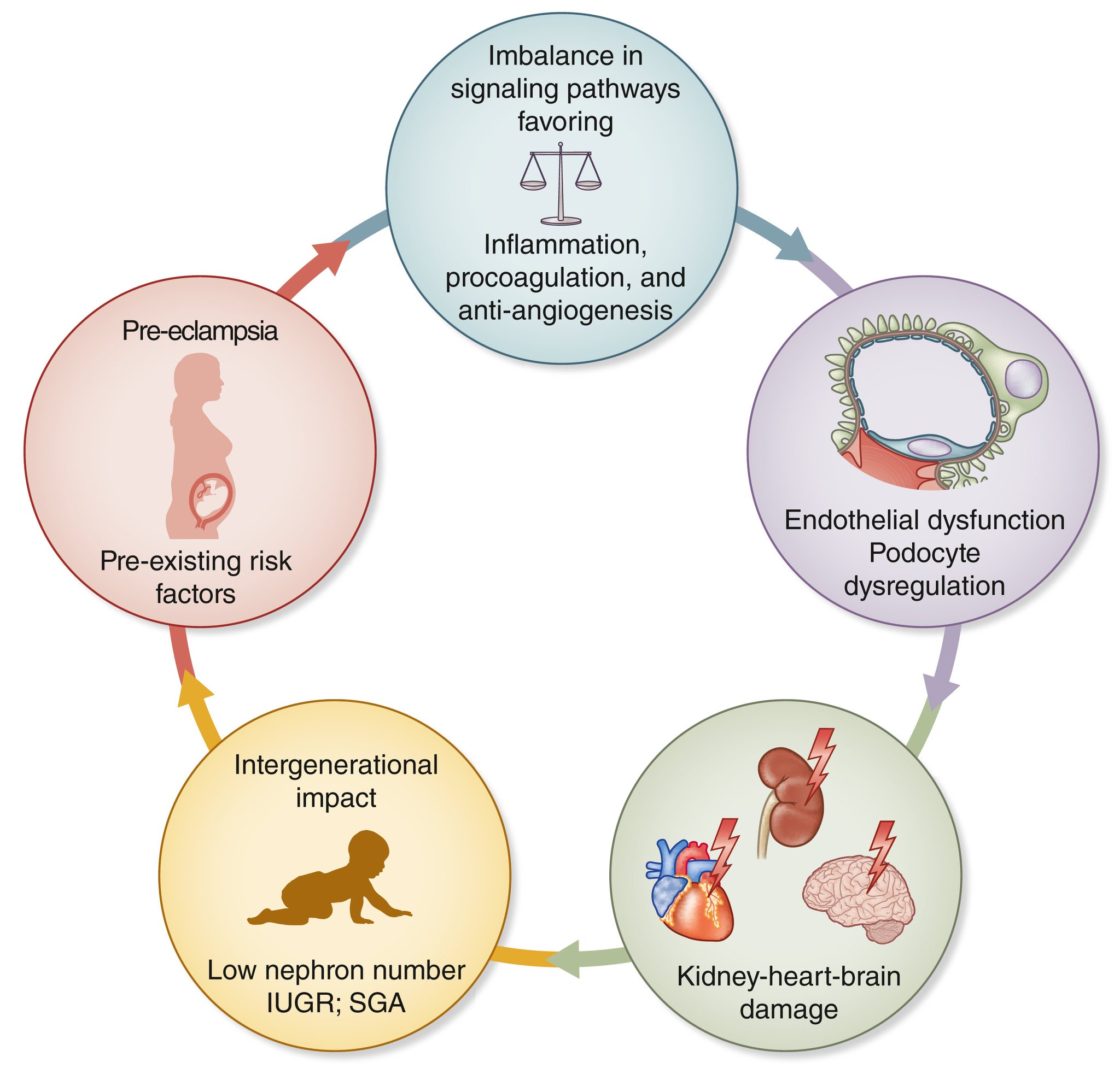 Kidney International on Twitter "KI Editorial A kidneycentric view of