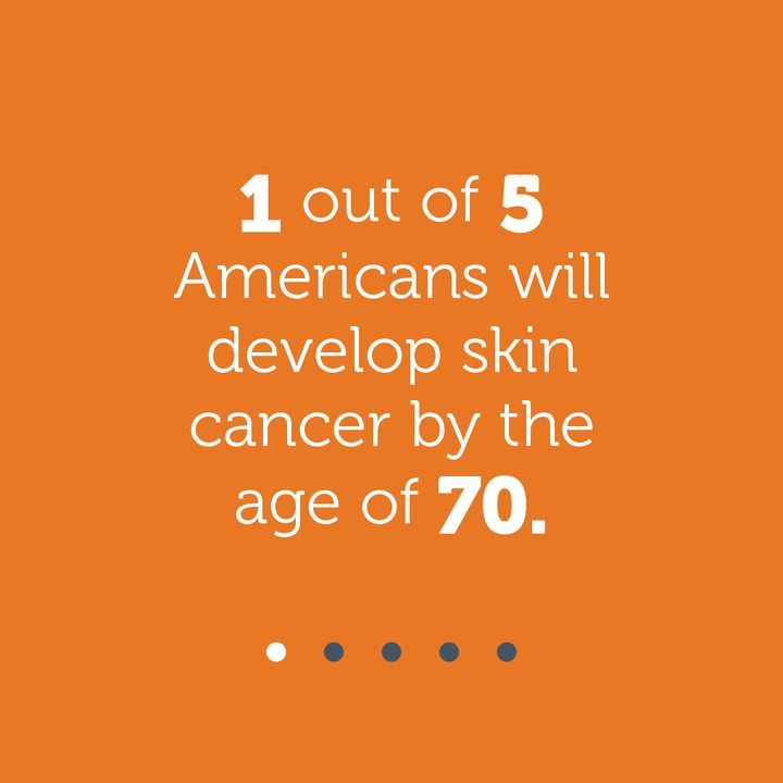CommHospAnd's tweet image. There are two main causes of skin cancer. The first is the sun’s ultraviolet (UV) rays, and the other is using UV tanning beds. Protect yourself and your family by wearing sunscreen and avoiding tanning.