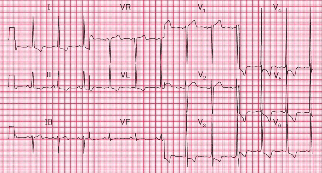 journal-of-brown-hospital-medicine-on-twitter-an-85-y-o-man-with
