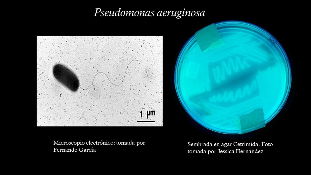 Jessica02371657's tweet photo. #2023BNTT #RedBIO #IPN     3/5
Pseudomonas aeruginosa es una bacteria patógena, presenta cepas multi y panresistentes con diversos mecanismos de acción contra antibióticos, afectando principalmente a personas inmunocomprometidas y con largas estancias hospitalarias. https://t.co/BTSu9bb7y1