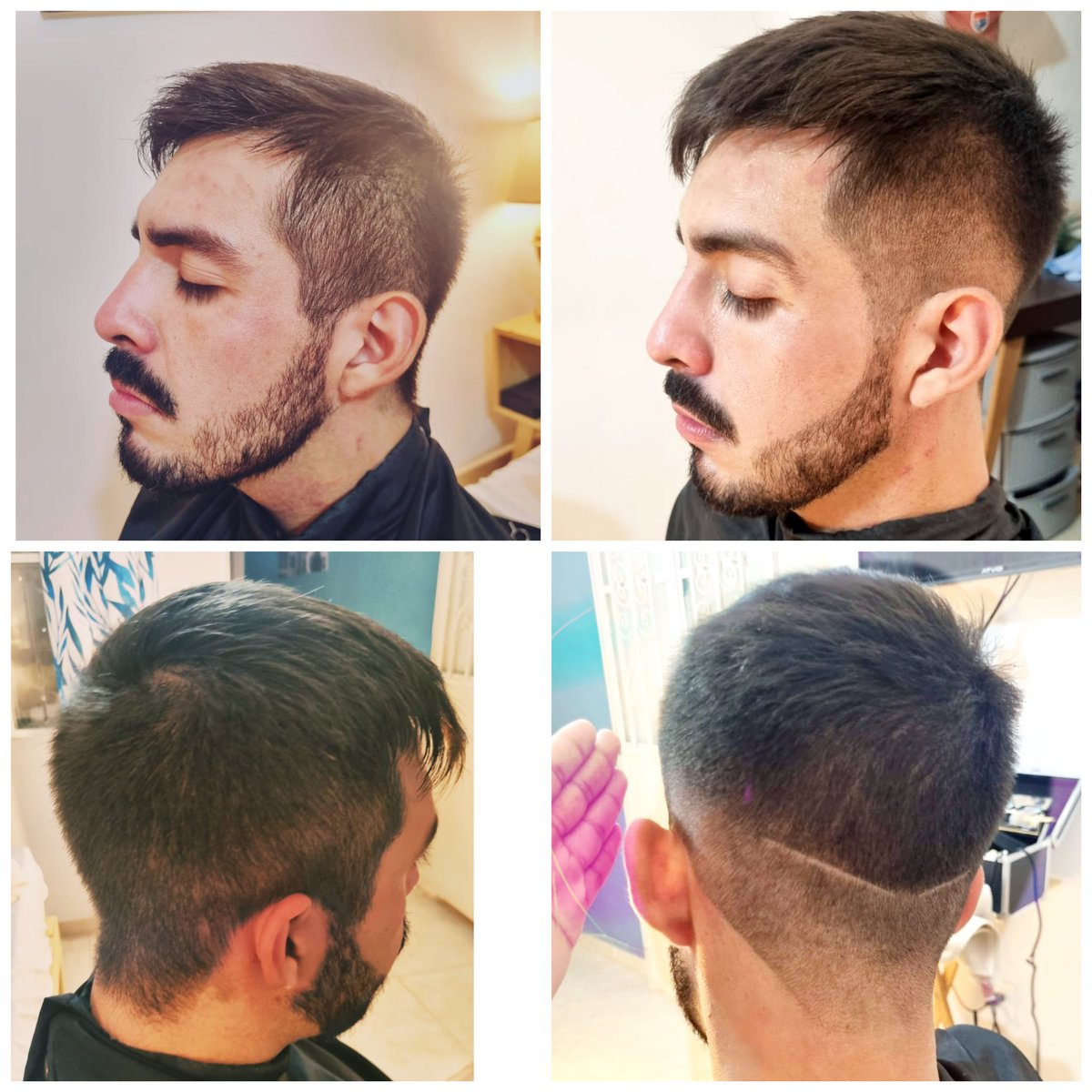 Before &amp; After , don't be scary 4 something diferent 💈💈💈💈+51-33-29-04-64-83 Home service 🏠🏬🏡🛕🏙️