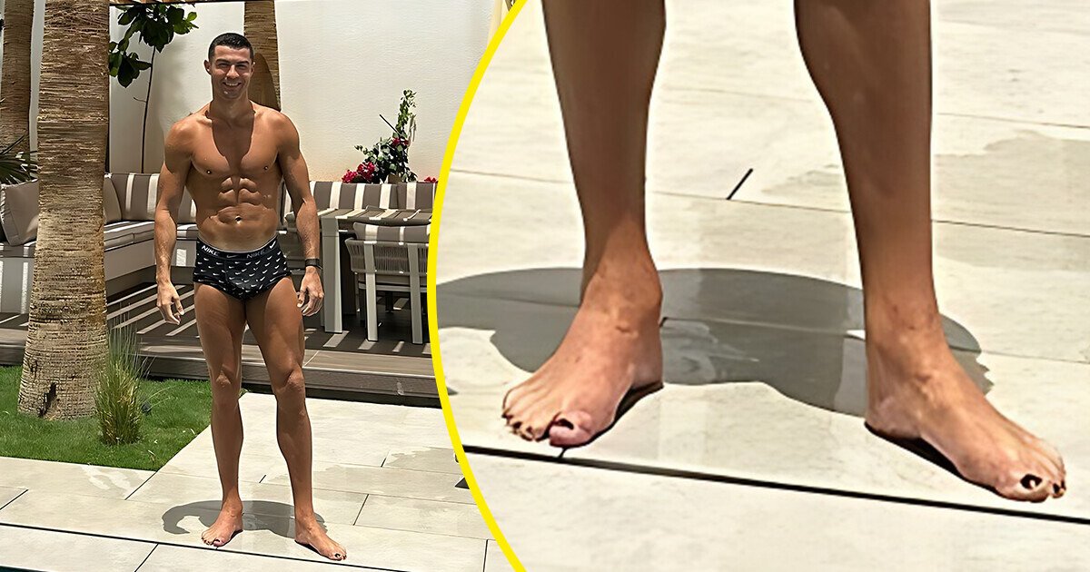 _BeFootball's tweet photo. Savez-vous pourquoi Ronaldo et d'autres sportifs se peignent les ongles en noir ?

La raison est simple : c'est pour se protéger des germes et des champignons et éviter qu'ils se cassent et fissurent ! https://t.co/tyrvsDxiLN