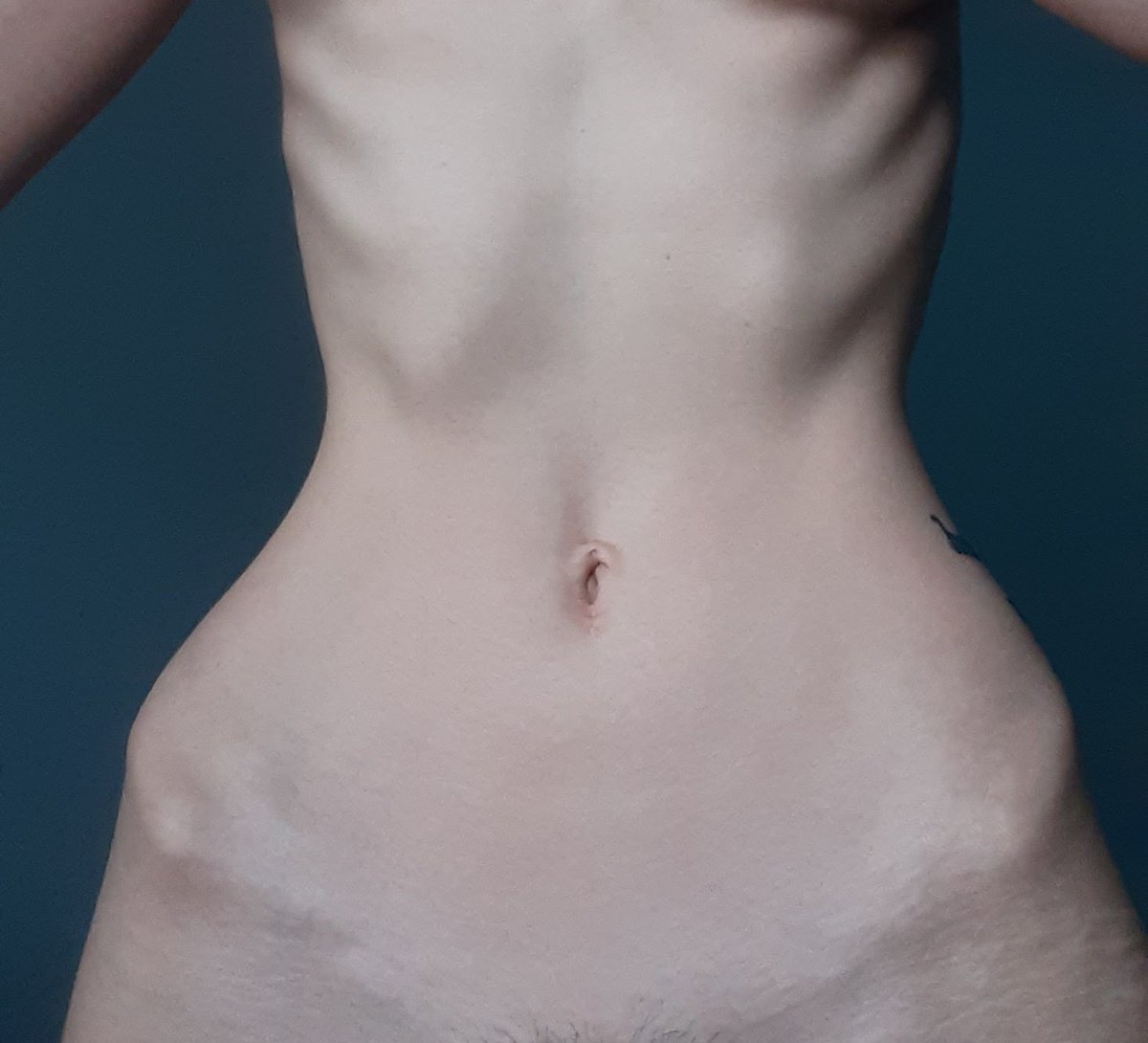 pinningwings's tweet image. TW bodycheck

i am not a well man