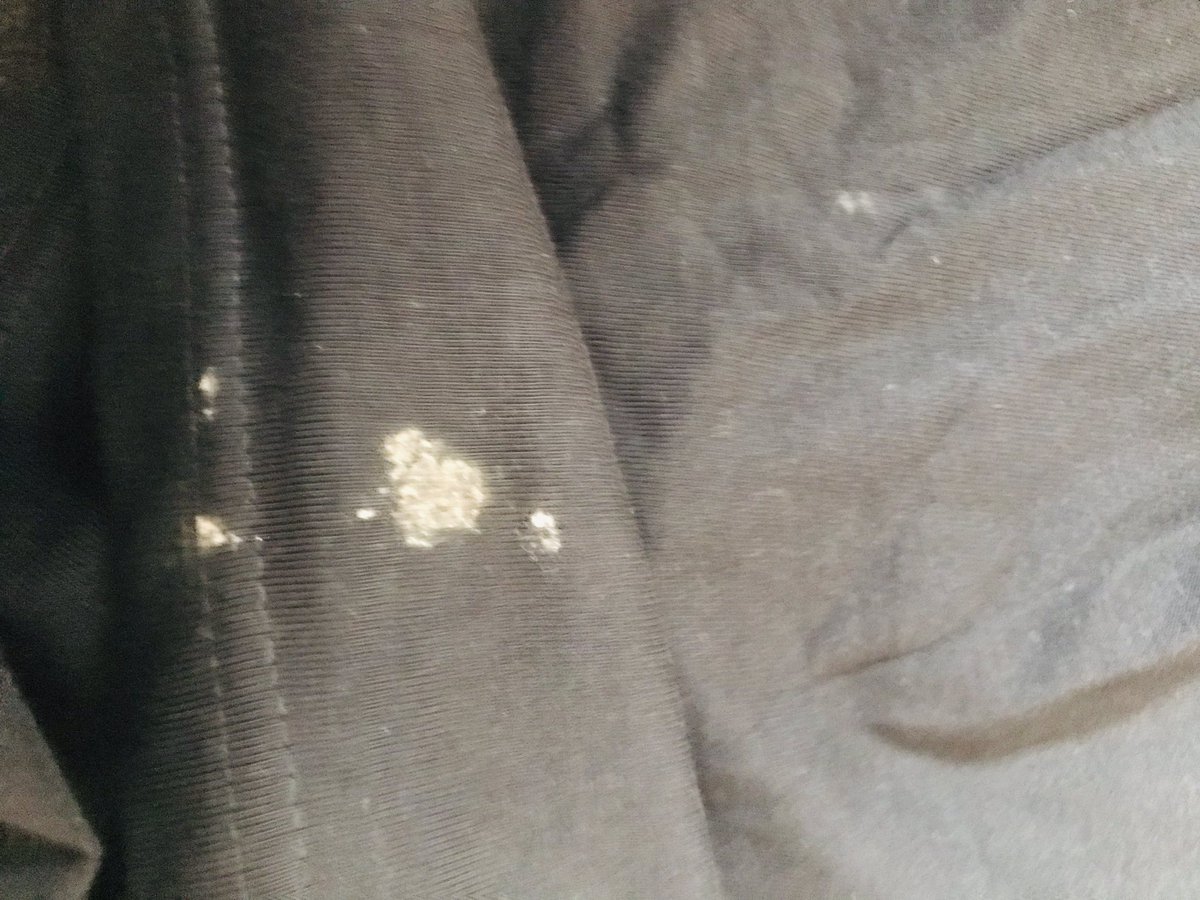 shubhamtwits's tweet photo. Hello
I have ordered first time via https://t.co/gOXj73oEmQ and I am disappointed with the product. One of the t shirt has sweat marks and smell like used t shirt. Sharing some pictures of the product. Kindly advice on next steps or parcel a new t shirt to replace it. https://t.co/8WwXbqAT3Q