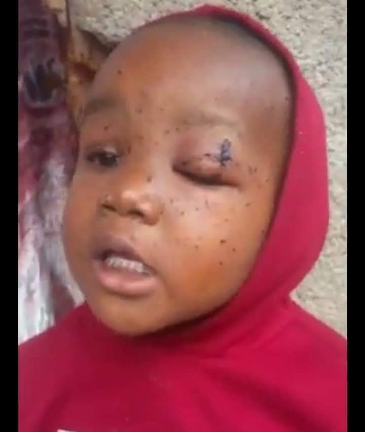 The guy was complaining to the cops about this kid, but instead, they broke his hand. The kid suffered burns after a tear gas canister landed in their house, setting seats on fire.