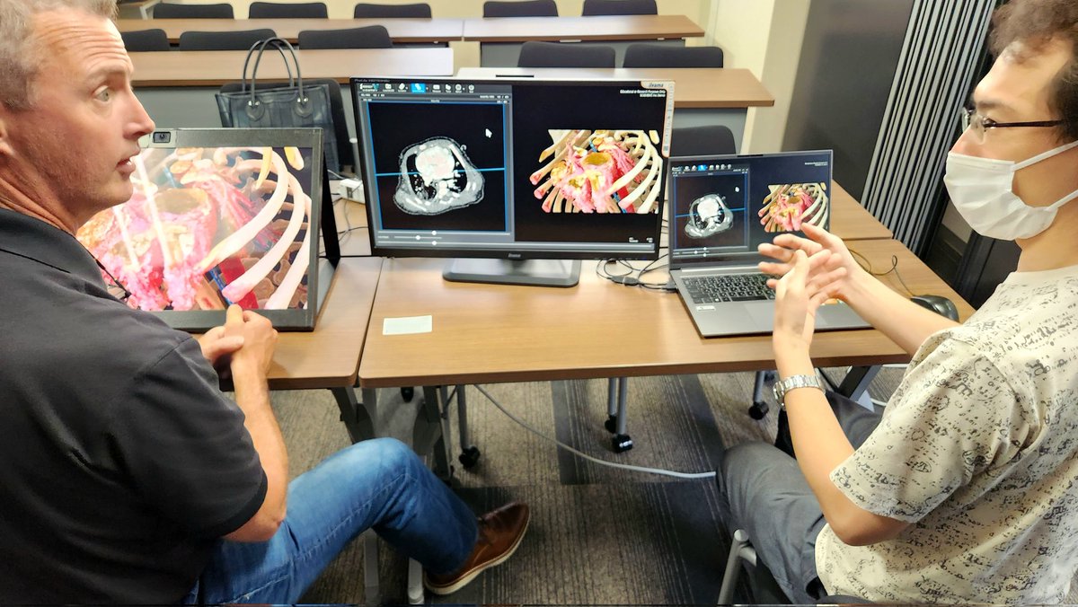 Sebastien Loze (@slfeeding) on Twitter photo Great conversation with <a href="/HirofumiSeo/">η¬ε°Ύ ζ‘ε² Hirofumi Seo, MD, PhD</a> from <a href="/viewtify/">viewtify</a> with <a href="/danwilli/">Danny Williams</a>
#UnrealEngine used to showcase patients #DICOM data, analyse them and get ready for procedures as used in #TokyoUniversity hospital. Great conversation with <a href="/HirofumiSeo/">η¬ε°Ύ ζ‘ε² Hirofumi Seo, MD, PhD</a> from <a href="/viewtify/">viewtify</a> with <a href="/danwilli/">Danny Williams</a>
#UnrealEngine used to showcase patients #DICOM data, analyse them and get ready for procedures as used in #TokyoUniversity hospital.