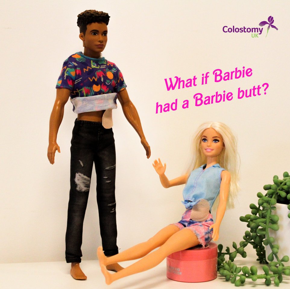 ColostomyUK's tweet photo. 'Proctectomy surgery' or 'Barbie Butt' surgery, is where your rectum and anus are removed and sewn up permanently. 

If you're soon to undergo #BarbieButt surgery, our helpline is open 24/7 to answer any questions you may have 💜 0800 328 4257

#BarbieMovie #BarbieTheMovie #Stoma https://t.co/J7gtl0eFZc