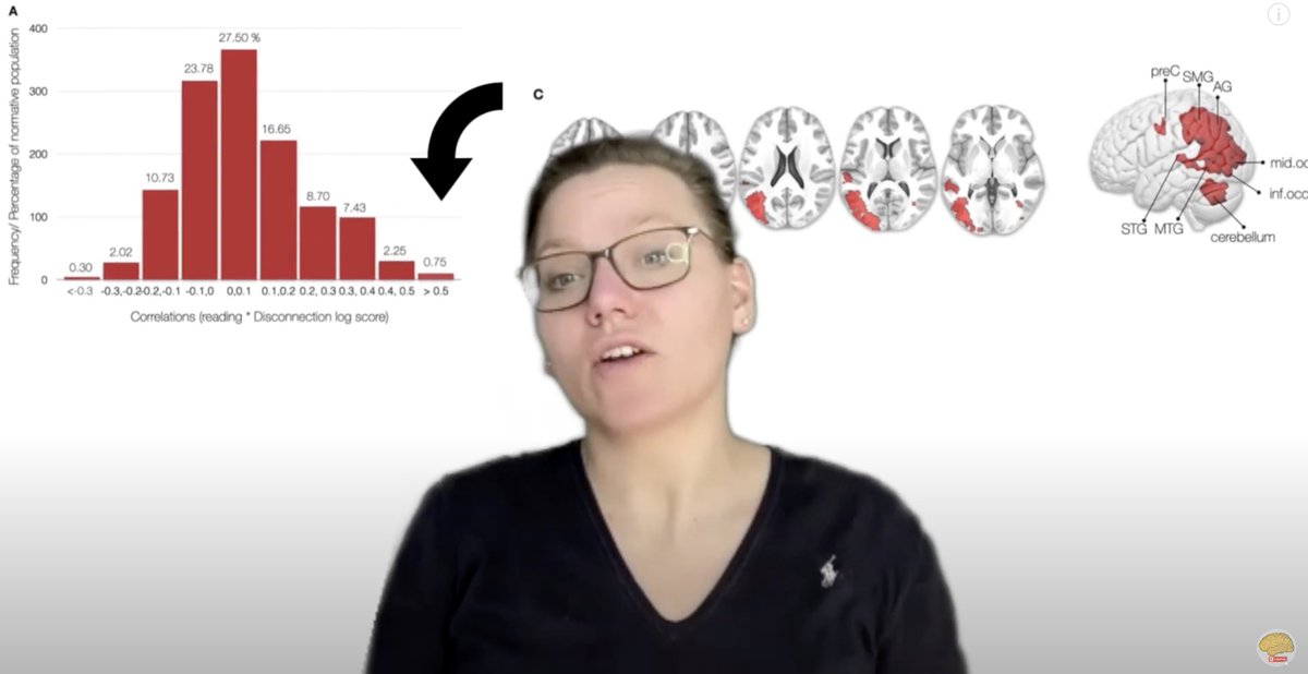 StephForkel's tweet photo. #posterpitch #Stroke #disconnectome decodes #reading networks
🎥 https://t.co/IViAuWZHGb
📝 https://t.co/N6hf12VXKu https://t.co/Ek3yG2xQzN