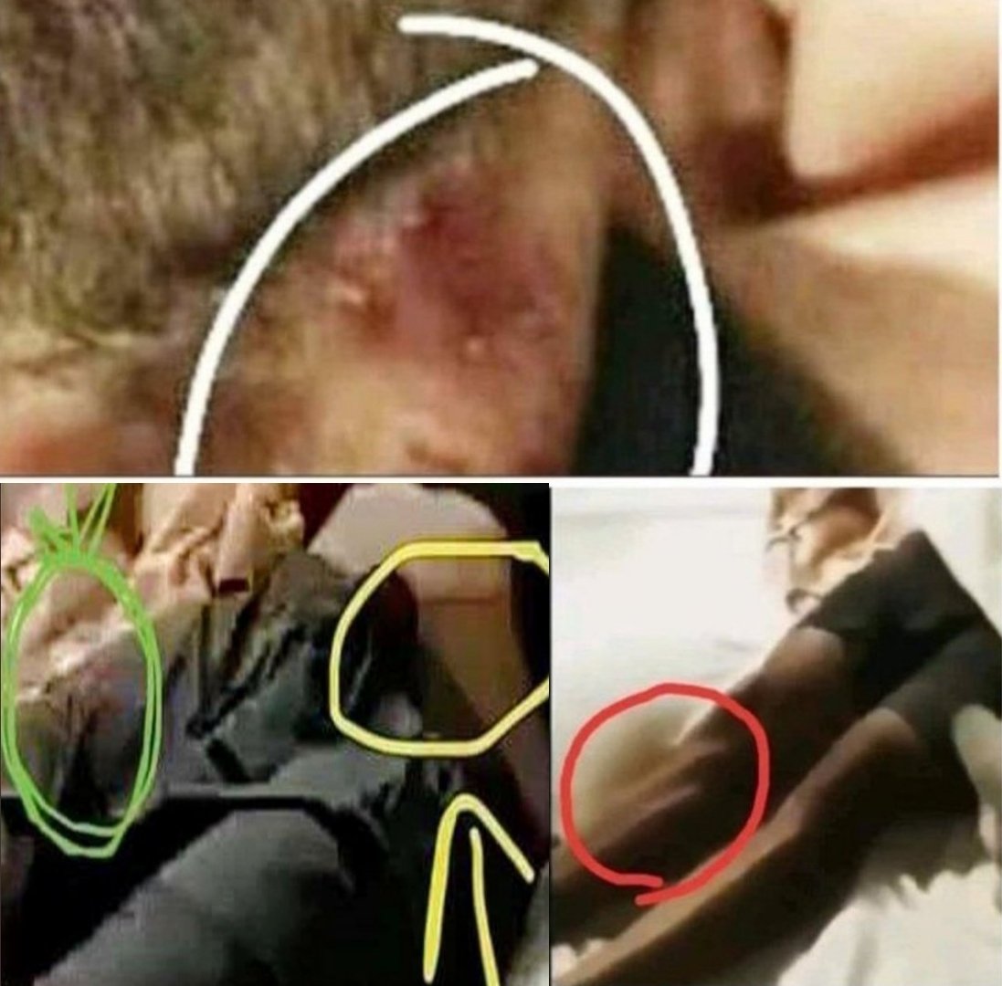 Yasmin2186's tweet image. Without actually examining Sushant&apos;s body how did #SudhirGupta conclude there were no injuries on d body other thn hanging,there was no marks of struggle on the body he relied on photos? How can the report be treated as conclusive?

@CBIHeadquarters
Justice4SSR Movement Of Masses