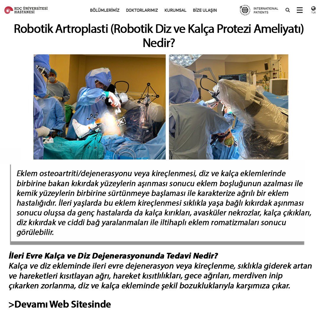 profmalideveci's tweet photo. “Robotik Artroplasti (Robotik Diz ve Kalça Protezi Ameliyatı) Nedir?” başlıklı yazımda robotik diz ve kalça protezi ameliyatını detaylı olarak sizler için anlattım.

https://t.co/I3zDkXCYgu

Sağlık ve sevgiyle kalmanız dileğiyle…

#docdrmehmetalideveci #mehmetalideveci https://t.co/m30oBU9xhp