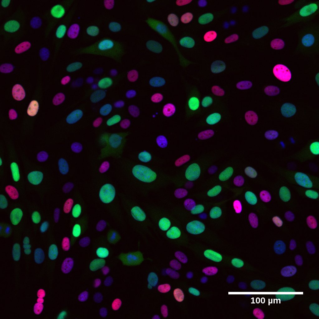 Mort Lab (@lab_mort) on Twitter photo Great to see our H2B-Cerulean-Fucci2a biosensor deployed in this lovely preprint - biorxiv.org/content/10.110… - from the Frame group <a href="/EdinUni_IGC/">Institute of Genetics and Cancer</a>. Track cells in G1 and S/G2/M with Fucci2a and early G1 and mitosis with H2B-Cerulean! <a href="/BLSLancasterUni/">BLS Lancaster University</a> #FluorescenceFriday #Microscopy Great to see our H2B-Cerulean-Fucci2a biosensor deployed in this lovely preprint - biorxiv.org/content/10.110… - from the Frame group <a href="/EdinUni_IGC/">Institute of Genetics and Cancer</a>. Track cells in G1 and S/G2/M with Fucci2a and early G1 and mitosis with H2B-Cerulean! <a href="/BLSLancasterUni/">BLS Lancaster University</a> #FluorescenceFriday #Microscopy