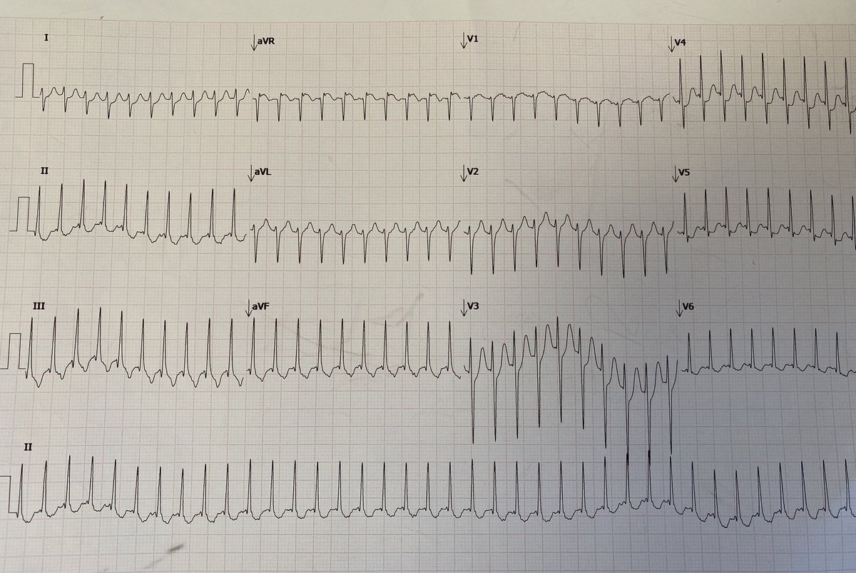 Javier Pérez Cervera tweet media