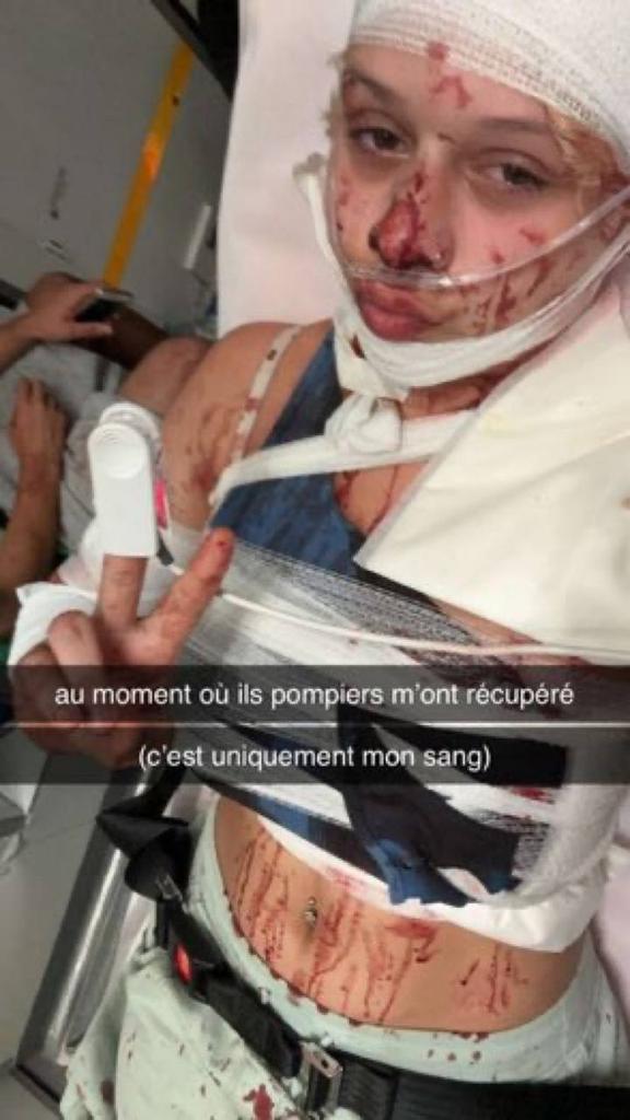 Toulouse : Agressée et défigurée avec des éclats de bouteilles par 4 Algériens qui l'ont d'abord traité de "salope"
Le visage de la jeune fille est méconnaissable et marqué à vie.
#Francocide