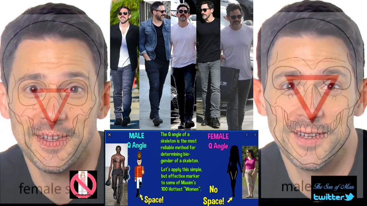 Steve Kazee fails the Forensic Tests/Bio female Skull match/5x the female gait/legs crossed/1 foot behind the other/1 x flamingo foot/but Fanx for playing CSI with me #forensics #CSI #Egi        
        ~ Its ALL of them.. No Exceptions https://t.co/gr13bWwmLi