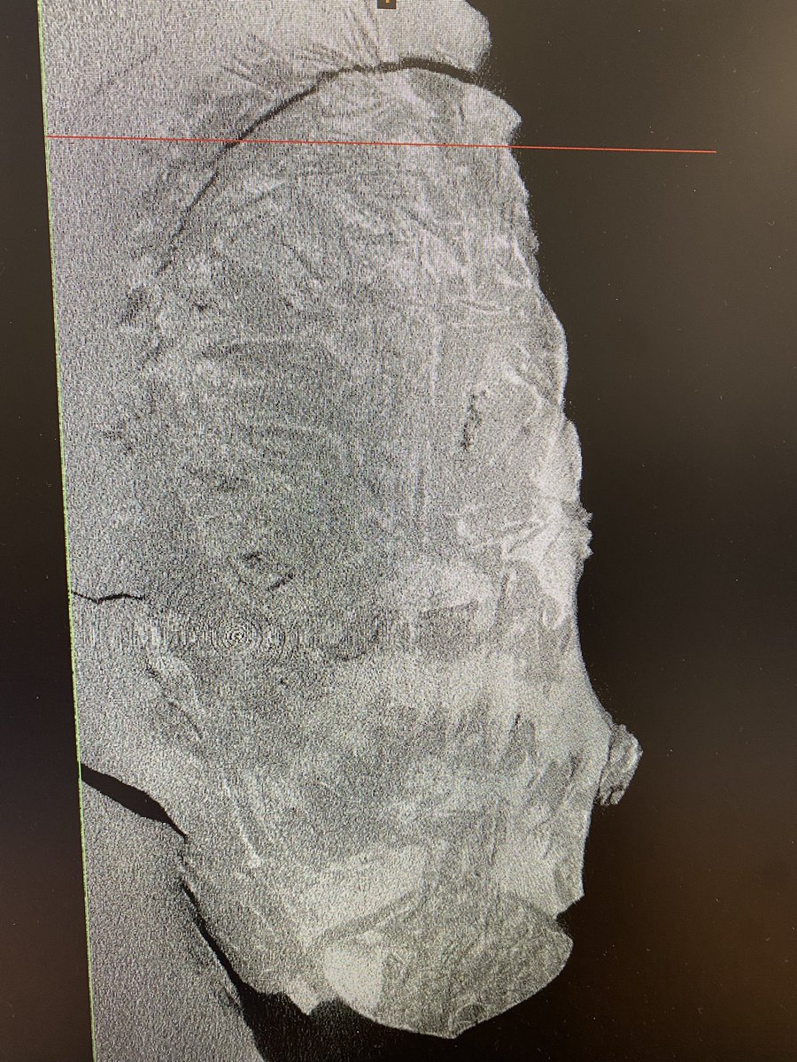 For #FossilFriday I’m going to indulge myself by spending some time segmenting this deliciously noisy CT scan. There’s a whole 3D skull in there, honestly 🤩