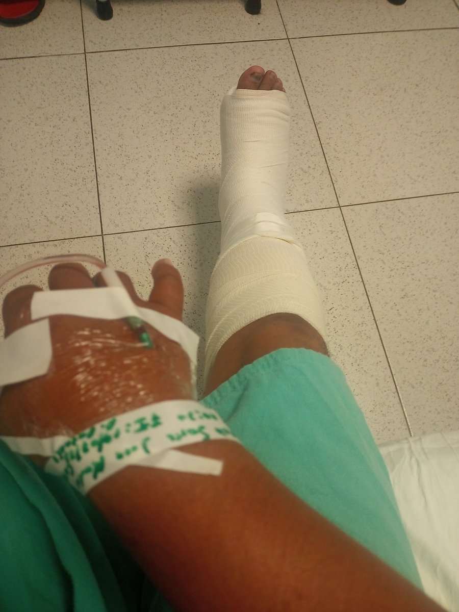 marjuam's tweet photo. Espero salir pronto de ésto, una pequeña fractura , lo bueno que ya estoy en minatitlan para pronta recuperación https://t.co/LiwYGfcUDQ