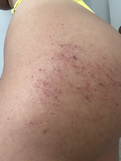 🖐🏻🇪🇸 https://t.co/K2o1NLVhxT