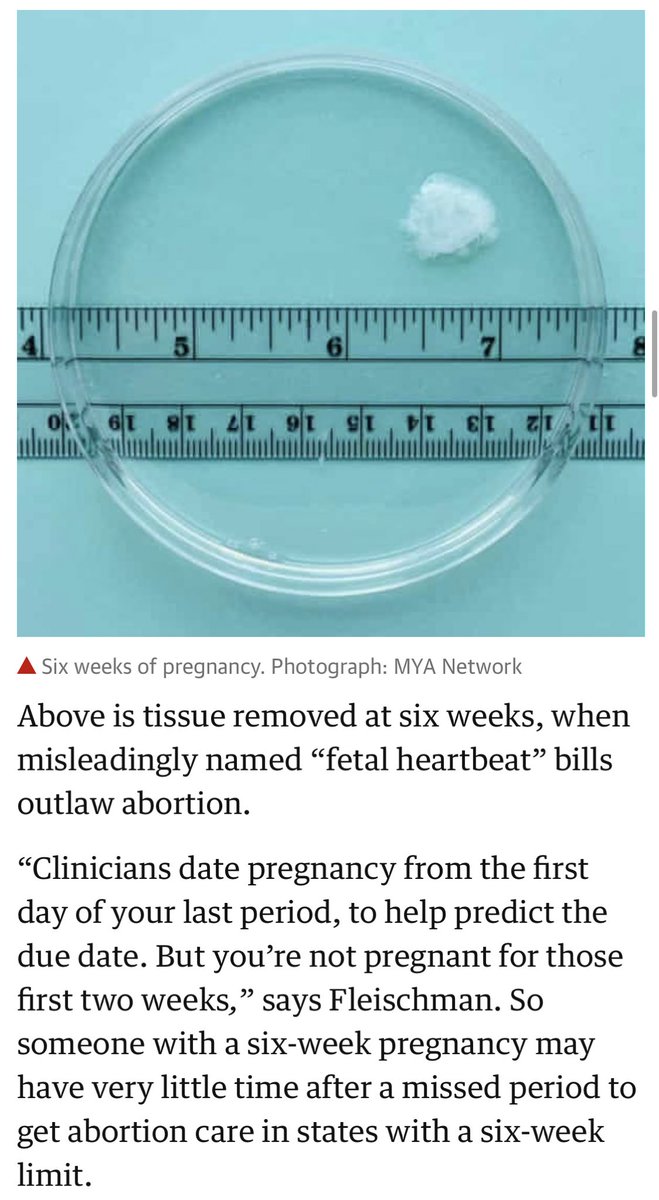 Recordatorio de que así luce un embarazo de 6 semanas realmente