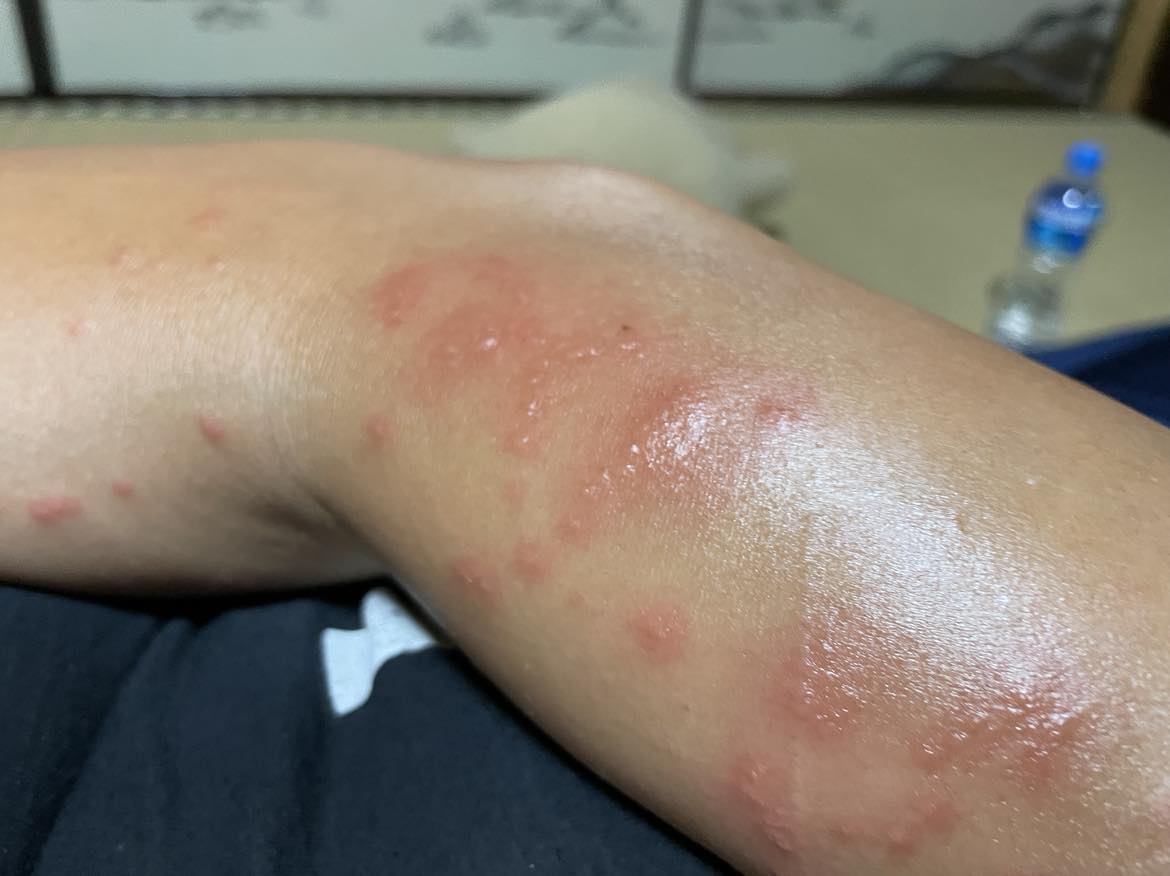 jake-adelstein-on-twitter-twitterdachi-my-sweetheart-got-stung