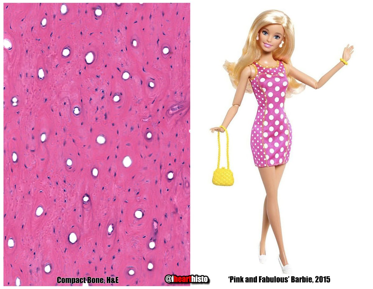 Barbie as histology tissues, a🧵:

#histology #anatomy #BarbieTheMovie #Barbenheimer #pathology