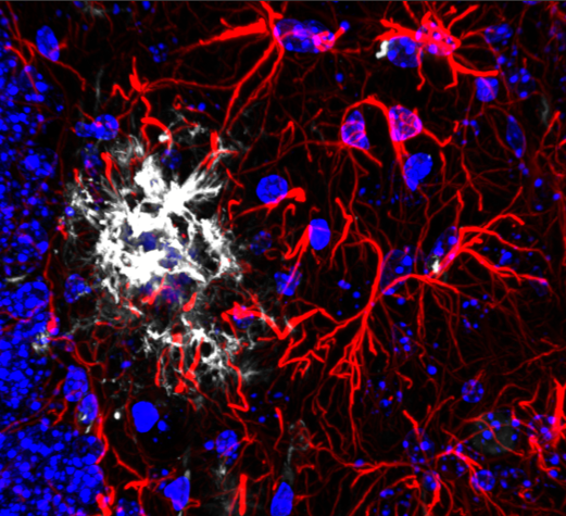 Zoe Tasma (@zoe_tasma) on Twitter photo Honored to be awarded a postdoctoral fellowship from <a href="/AlzCanada/">Alzheimer Society of Canada</a> to research astrocytes in Alzheimer’s disease! The ASRP invested $6 million in 44 dementia researchers across Canada this year to combat the disease. Read more at: alzheimer.ca/ASRP2023 <a href="/LabFerguson/">Ferguson Lab (University of Ottawa)</a> <a href="/OttawaCmm/">uOttawaCMM</a> Honored to be awarded a postdoctoral fellowship from <a href="/AlzCanada/">Alzheimer Society of Canada</a> to research astrocytes in Alzheimer’s disease! The ASRP invested $6 million in 44 dementia researchers across Canada this year to combat the disease. Read more at: alzheimer.ca/ASRP2023 <a href="/LabFerguson/">Ferguson Lab (University of Ottawa)</a> <a href="/OttawaCmm/">uOttawaCMM</a>
