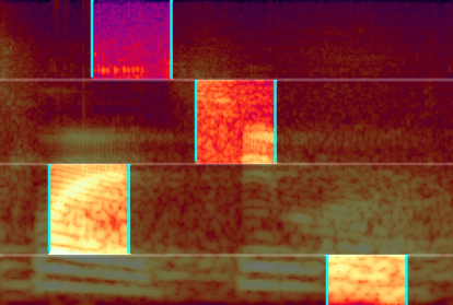 weareaudiokids's tweet photo. With Multi-Band granular synthesis, the spectrum of each grain is split in multiple frequency ranges, and for each range a different position in the sample is used. Also, each range can have different synthesis parameters. https://t.co/CQVUcHdOPa