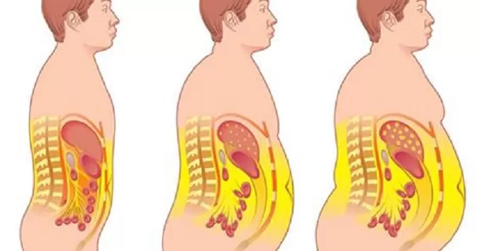 rep_ranger's tweet photo. Comment perdre la graisse du ventre et obtenir des abdominaux parfaits ?

Vous trouverez ci-dessous tous mes conseils pour y parvenir le plus rapidement possible : https://t.co/kqsta8NMye