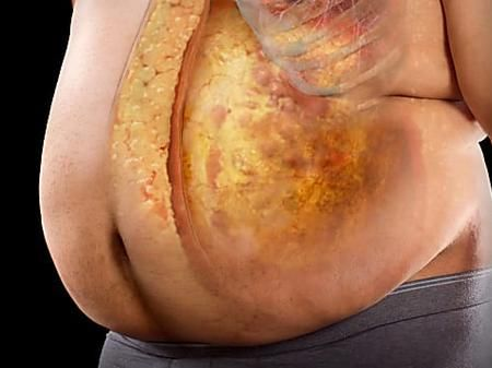 rep_ranger's tweet photo. Comment perdre la graisse du ventre et obtenir des abdominaux parfaits ?

Vous trouverez ci-dessous tous mes conseils pour y parvenir le plus rapidement possible : https://t.co/kqsta8NMye