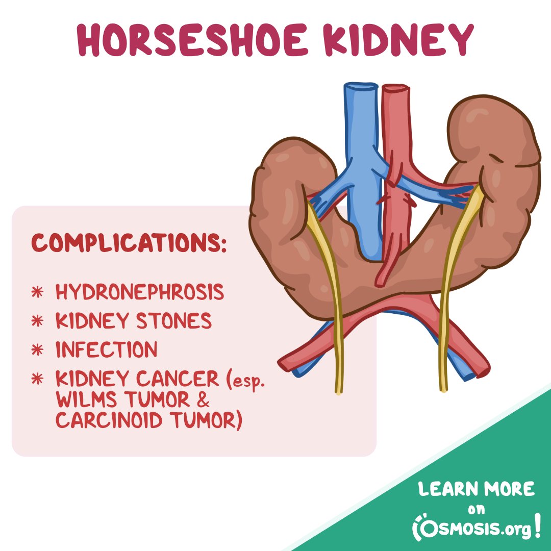 Osmosis from Elsevier on Twitter "This one's for all of the horse