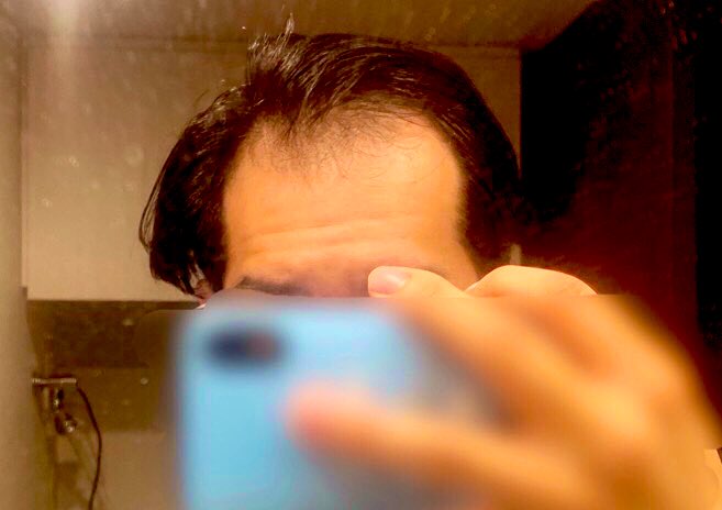 i___am___wasabi's tweet image. 👨🏻‍🦲會澤●輝(28歳)👨🏻‍🦲
●写真同一人物です( ˙᷄ỏ˙᷅ ) ᵒᵐᵍ

株式会社Monolith誕生前の
株式会社President時代から
所属している古参会員

現在、株式会社Monolithを辞め
情報商材の販売
◓⃙⁣ポケモンカードの転売
そして
OBとしてMore(OneHundred)の
【セミナーにも登壇】

人気者だ

#OneHundred