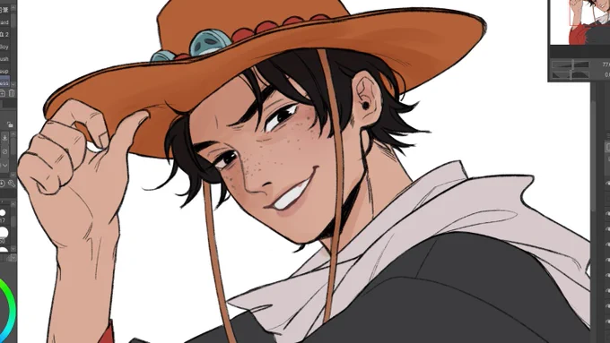 freckles