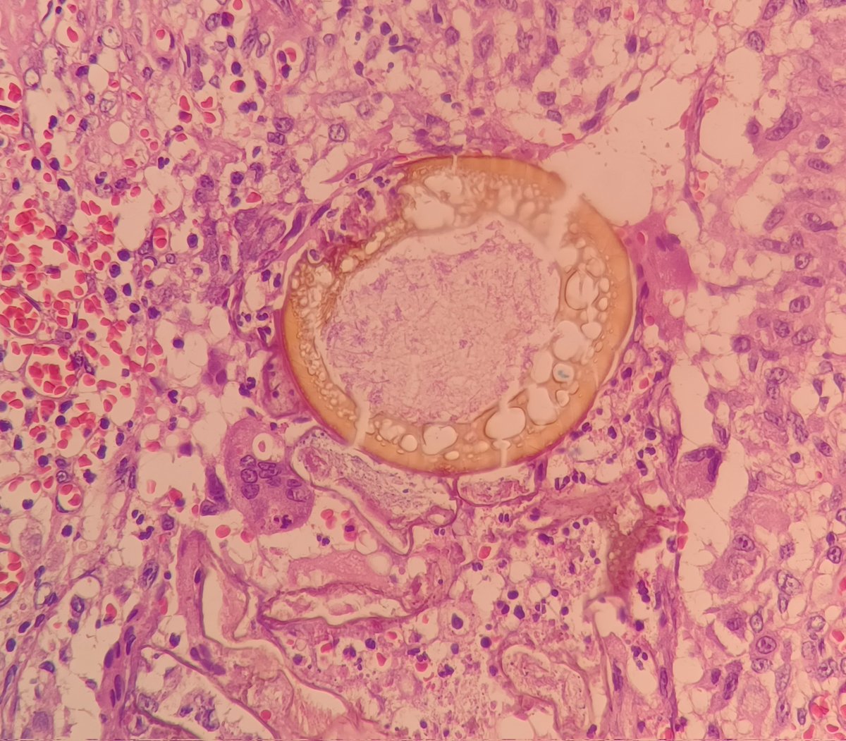 Alicia Núñez Abreu, MD🔬🇩🇴 tweet media