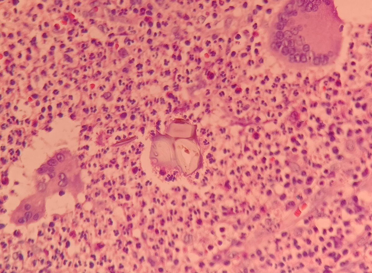 Alicia Núñez Abreu, MD🔬🇩🇴 tweet media