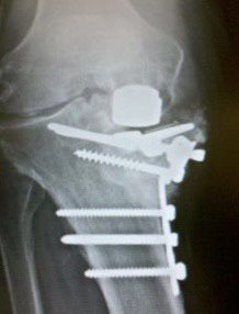 disasterplasty tweet media