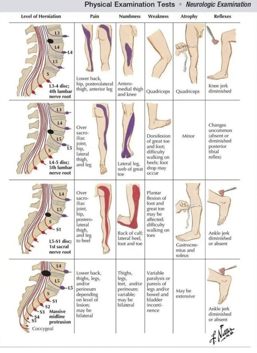 Leg neuro exam from Frank Netter