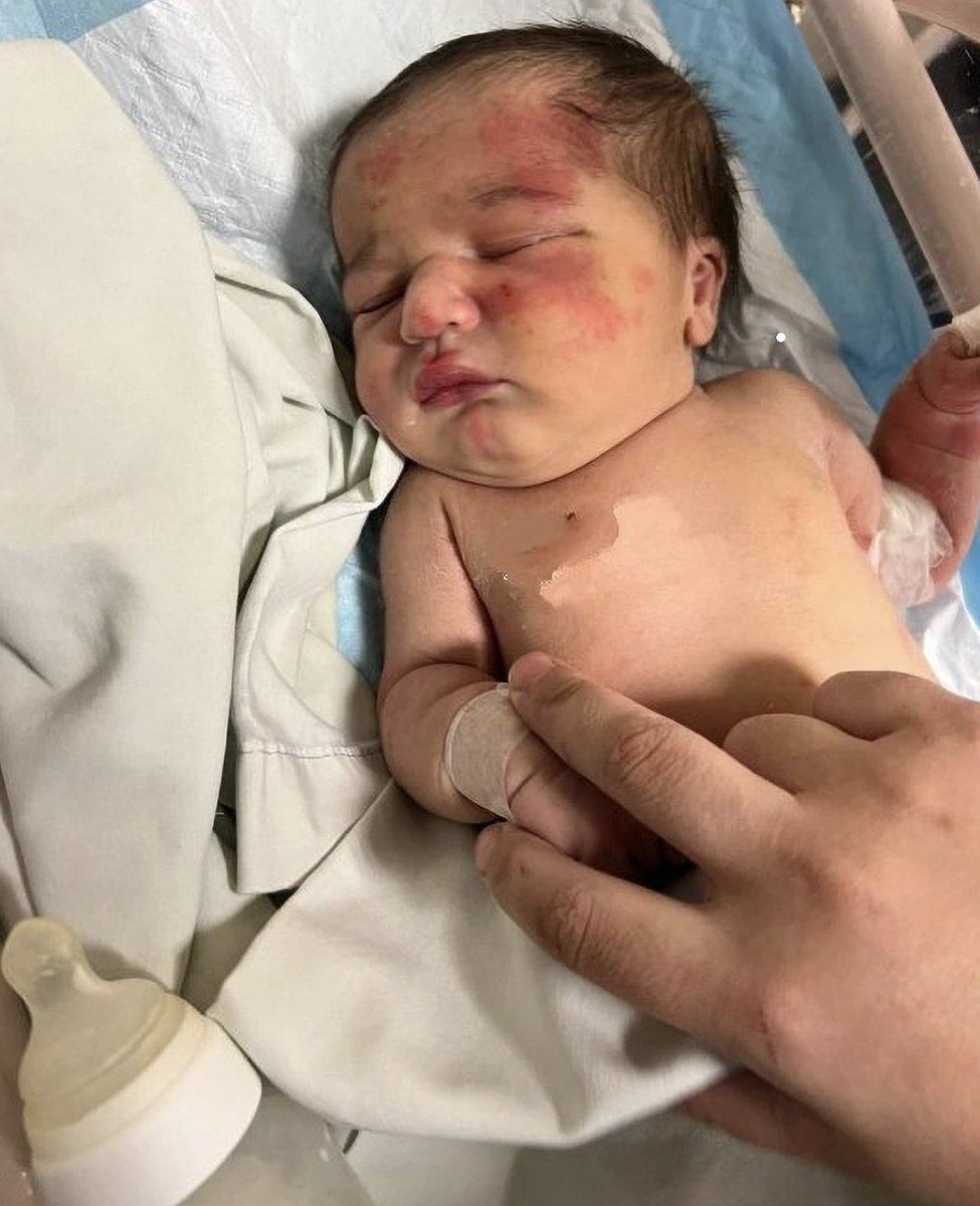 🔥🚨Developing: This baby was carried to safety by stray dog after being abandoned in trash.