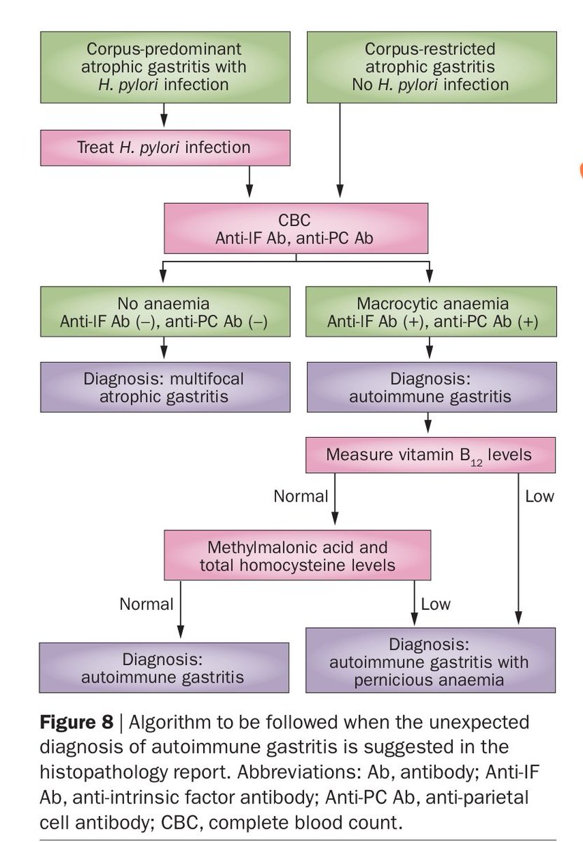 drdeepakmadhu's tweet photo. 🌟The unexpected diagnosis of autoimmune gastritis suggested on biopsy report🌟

Picture courtesy, suggested reading: https://t.co/XhapS77MxY https://t.co/6X6n74eFeS