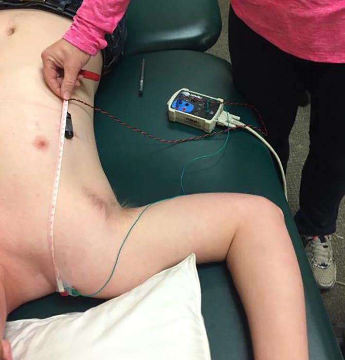 ClinicalNeuroph's tweet photo. [Long thoracic nerve conduction velocity] Galloway et al. described a new technique to record long thoracic nerve conduction velocity through the axilla.  

https://t.co/bI3dQfQbMg
@BelmontUniv
#NerveConduction #ClinicalNeuroph https://t.co/CMdaLMWkhi