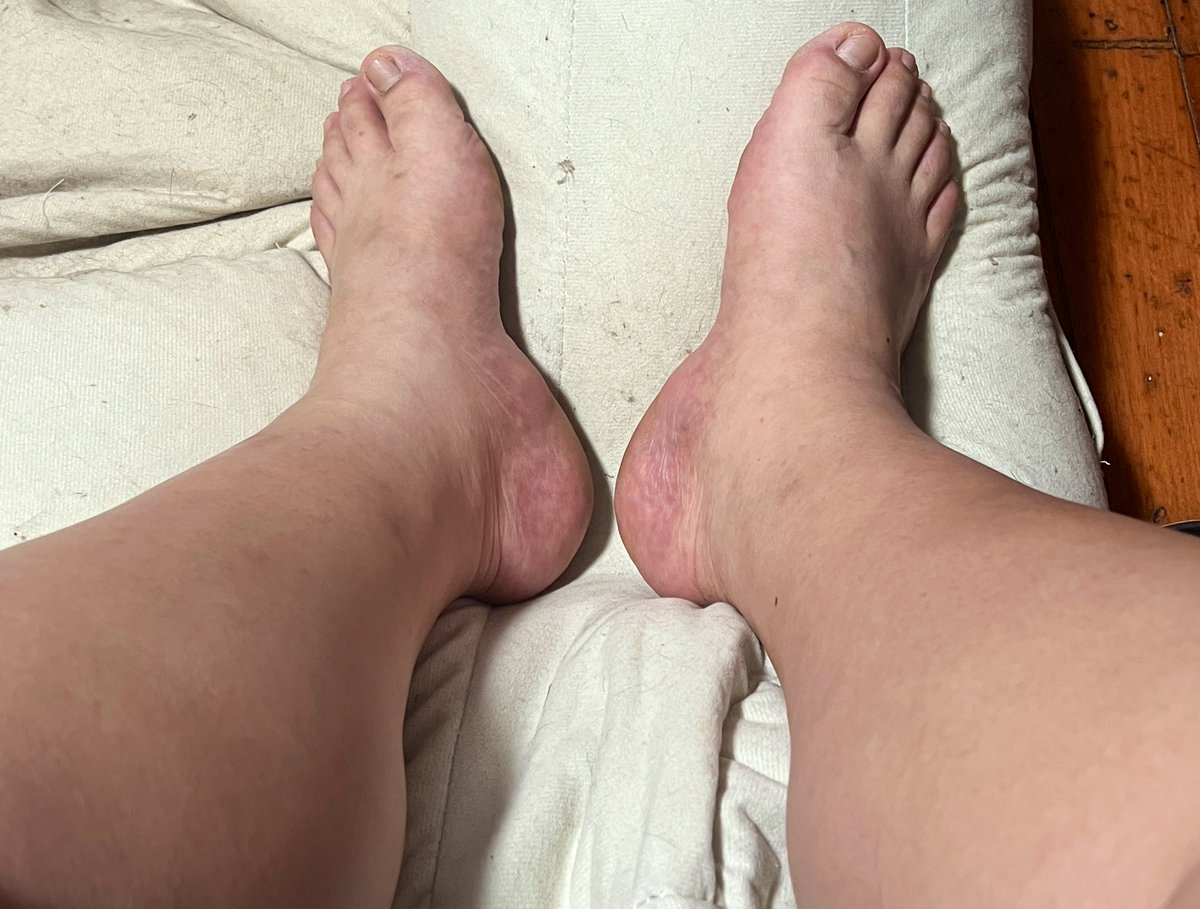 huhu (@fathuhubear) on Twitter photo 