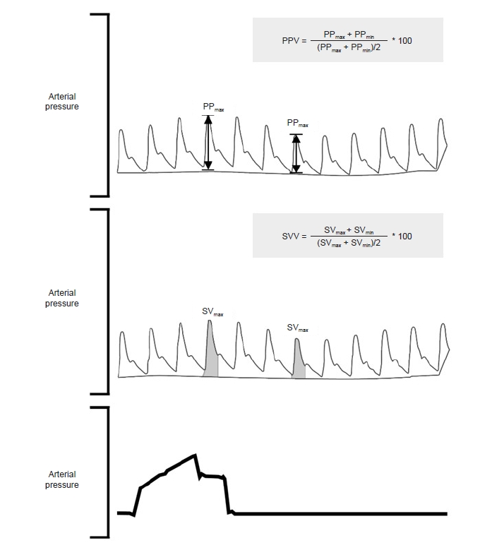 Predictors of fluid responsiveness in the operating room: A narrative review

CCR Journal Watch
criticalcarereviews.com/latest-evidenc…

Get the latest critical care literature every weekend via the CCR Newsletter - subscribe at criticalcarereviews.com/newsletters/su…