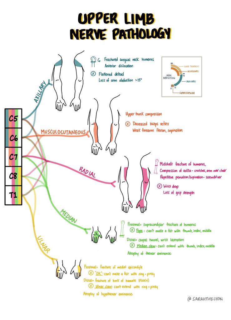 imedverse's tweet photo. Upper Extremity Nerve Pathologies

@sarahthelyon #MedEd #MedTwitter https://t.co/61zlOfIxe6